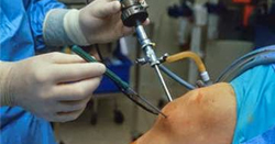 Indriati Orthopedic Center